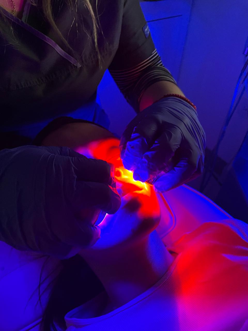 Hydrafacial