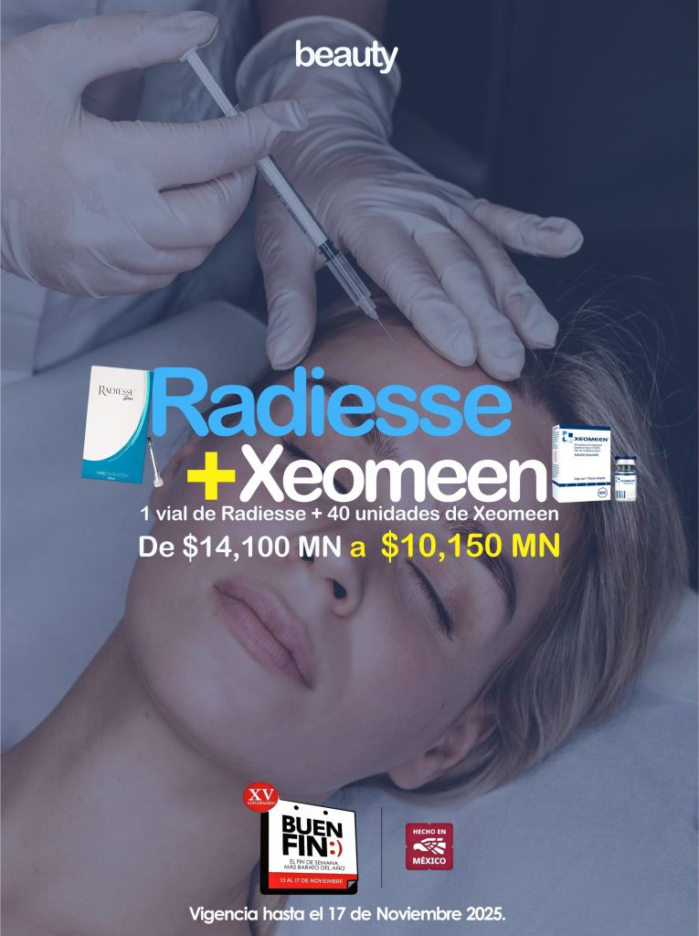 Radiesse + Xeomeen