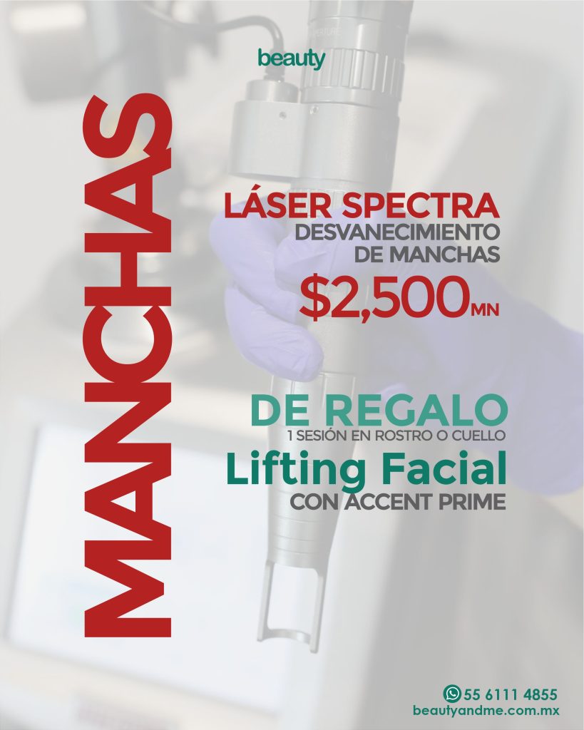 accent prime gratis